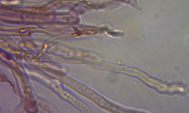 Dacrymyces variisporus